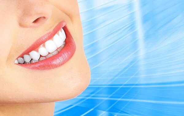 Teeth Whitening in Malaysia: Unlocking the Secret to a Radiant Smile